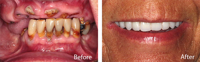 before and after treatment at Sheldon and Furtado, PLLC