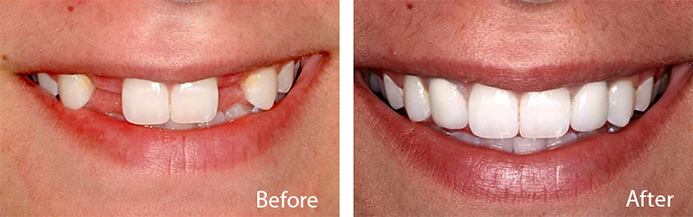 before and after treatment at Sheldon and Furtado, PLLC