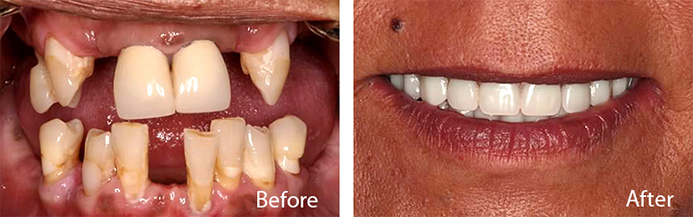 before and after treatment at Sheldon and Furtado, PLLC