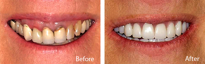 before and after treatment at Sheldon and Furtado, PLLC