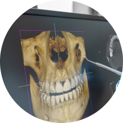 Cone beam CT scanner 3D image of the jaw and skull