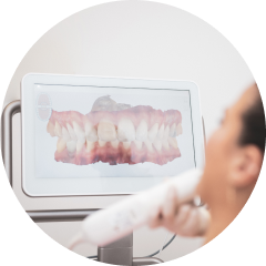 Intra-oral scanning wand taking a digital impression