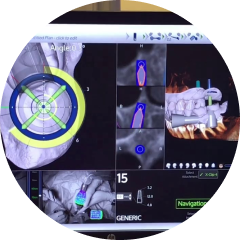 Computer-generated surgical guide for implant placement
