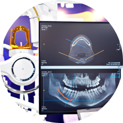 Implant treatment planning software on a monitor