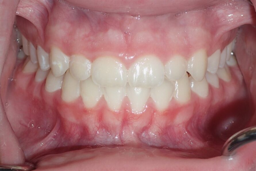 Before image