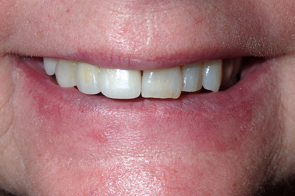 Before image
