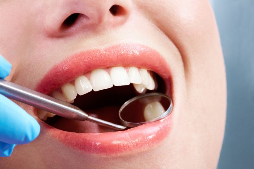 close up of a smile during oral exam