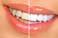 Cosmetic Dentistry Melbourne