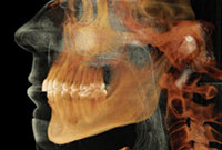 dental x-ray